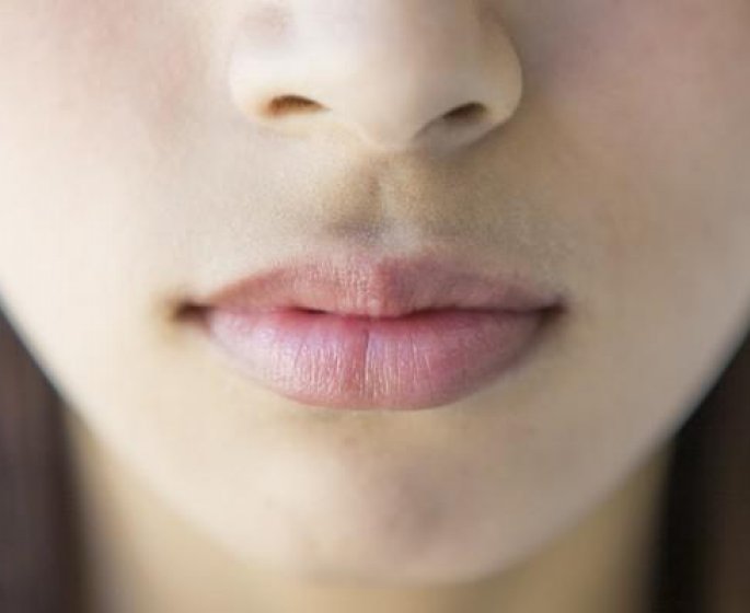Polype nasal : les symptomes