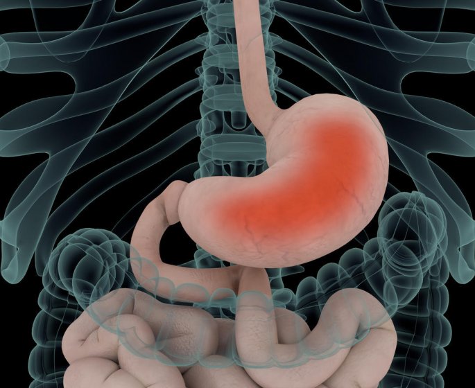Estomac : les 3 symptomes d-une gastrite