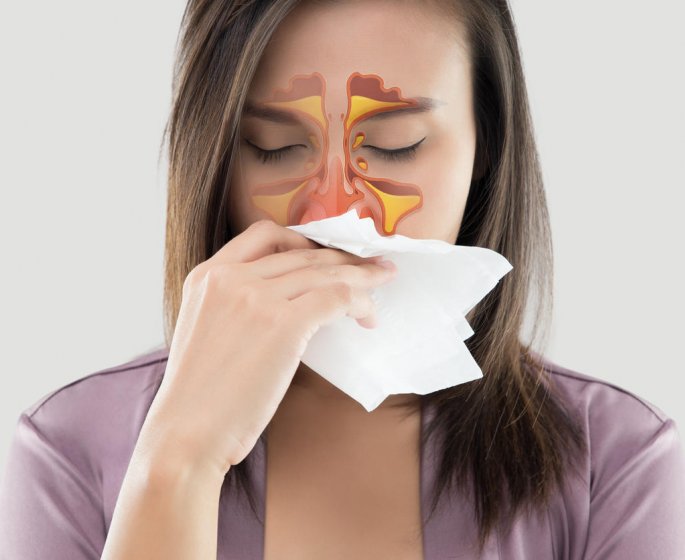 6 signes qui montrent que vos sinus sont bouches