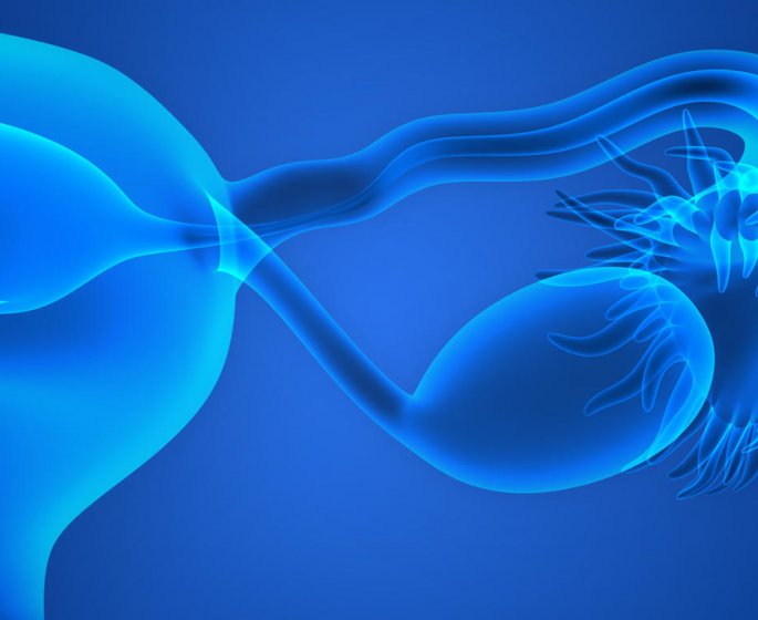 Cancer de l-ovaire : le traitement par ovariectomie
