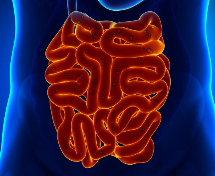 Cancer de l-intestin grele : une diarrhee motrice comme symptome