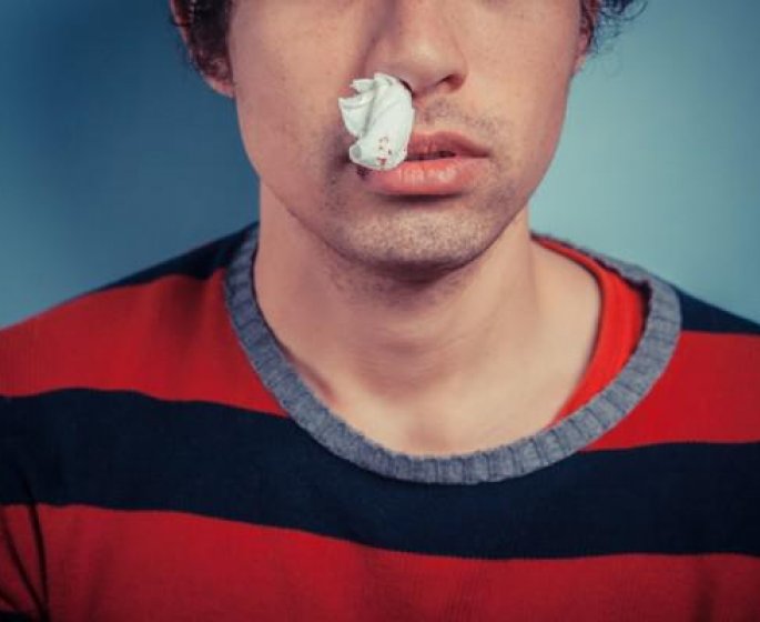 Polype nasal qui saigne : que faire ?