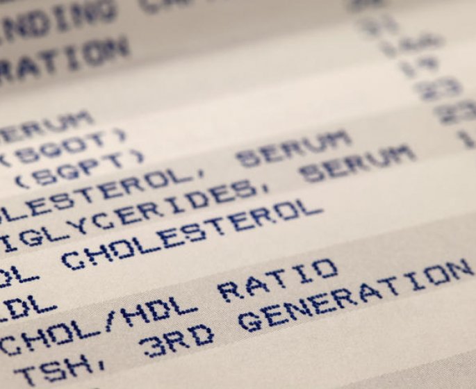 Cholesterol : les conseils d-une cardiologue pour le reduire rapidement apres les fetes
