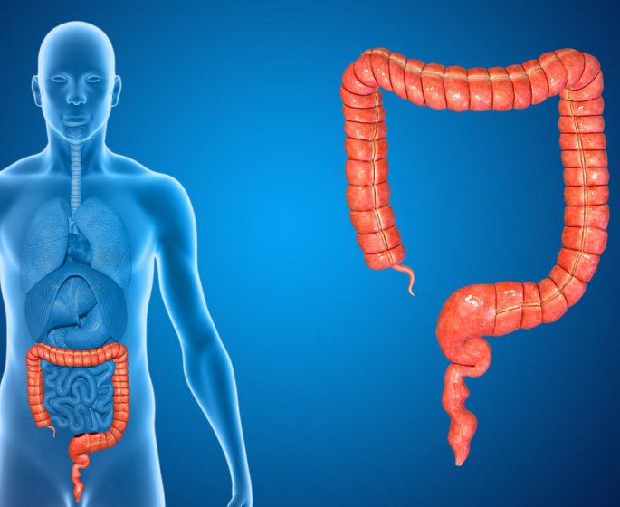 Polype au colon : ce n-est pas forcement un cancer