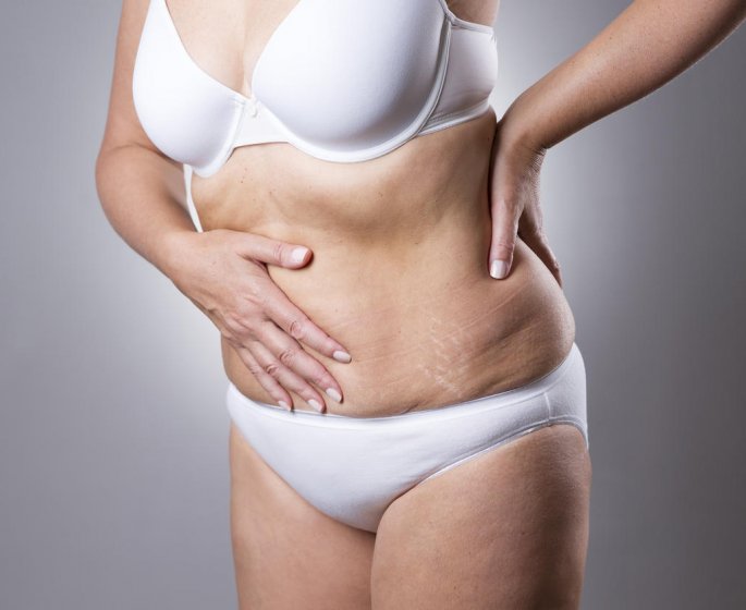 Douleurs en bas du ventre : de quel cote est l-appendicite ?