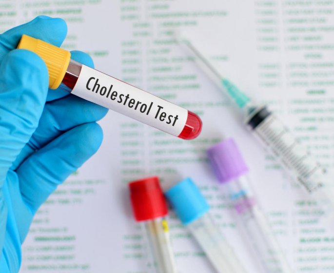 Dosage sanguin du cholesterol : interpreter les resultats