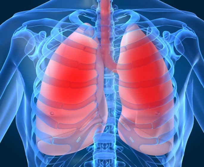 Pneumonie aigue frontale : la definition