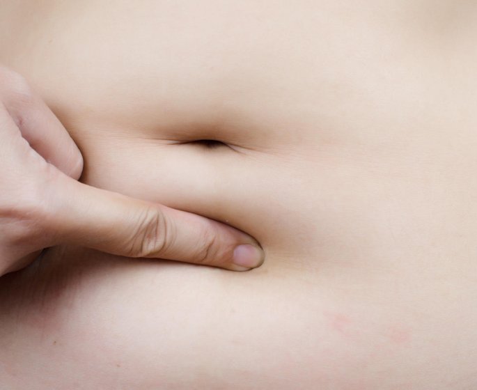 Les causes d-un gros ventre chez la femme qui n-est pas enceinte