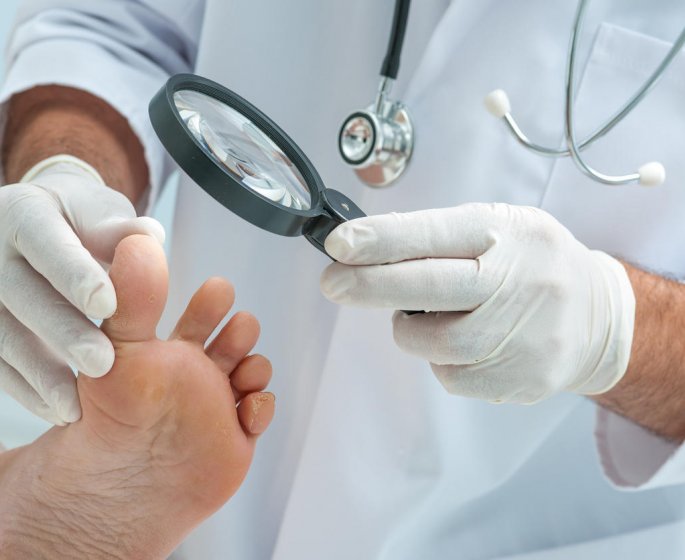 Panaris au doigt, pied ou a l-orteil : comment le reconnaitre et le soigner ?