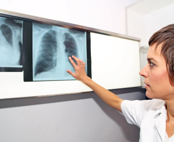 Embolie pulmonaire : 7 facteurs de risque a connaitre