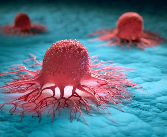 Cancer : quels sont les signes des cancers les plus meurtriers ?