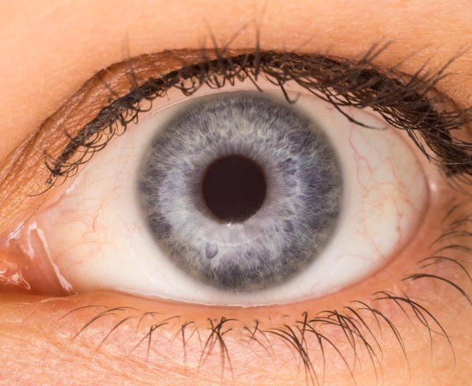 Maladie des yeux : la nevrite optique