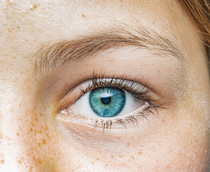 Cancer de l-œil : 7 signes a ne pas negliger