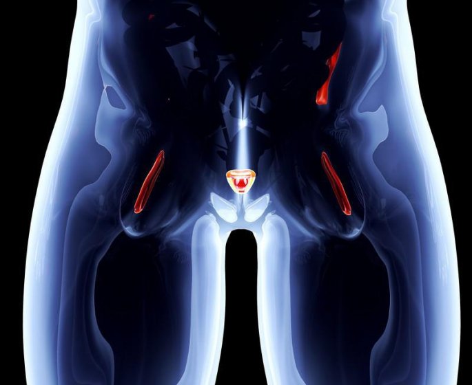 Cancer de la prostate : zoom sur l-examen TEP-choline