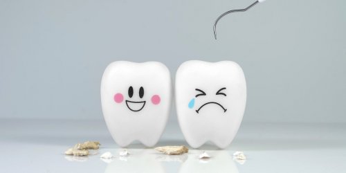 Tartre sur les dents : comment se forme-t-il et l-enlever ?