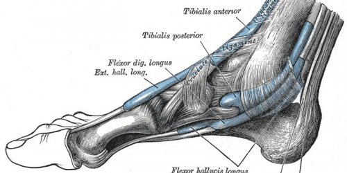Hallux rigidus (arthrose du gros orteil) : quelle operation pour le soigner ?