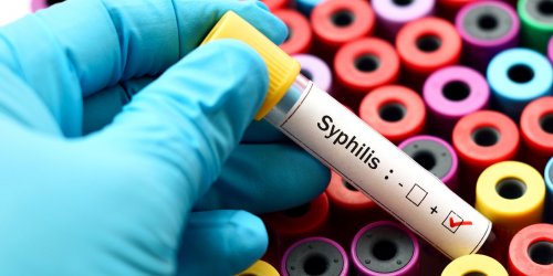 Syphilis : symptomes, traitements, transmission et depistage