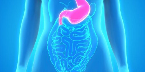 Ulcere gastrique : le risque de recidive