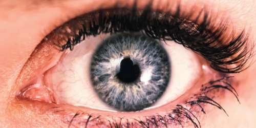 Yeux : comprendre la cataracte bilaterale