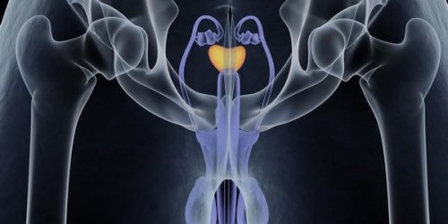 Cancer de la prostate : les signes d-alerte des metastases