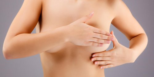 Ecoulement mammaire : un symptome de carcinome canalaire