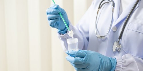 Cancer du col de l-uterus : les tests HPV, un depistage plus fiable pour les plus de 30 ans