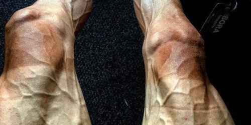 La photo choc des jambes d-un cycliste du Tour de France