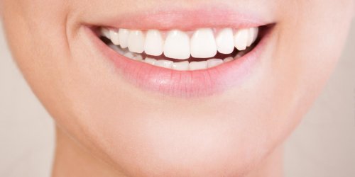 Blanchiment des dents : comment utiliser une gouttiere dentaire