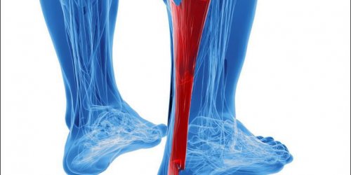 Rupture partielle du tendon d-Achille : les signes