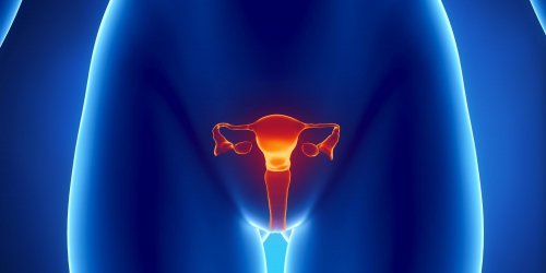 Polype a l-uterus : un signe de cancer ?