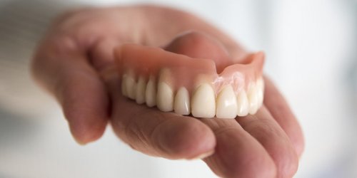 Prothese dentaire amovible ou fixe : les differences de tarif
