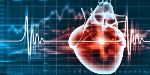 7 choses qui peuvent declencher un arret cardiaque 