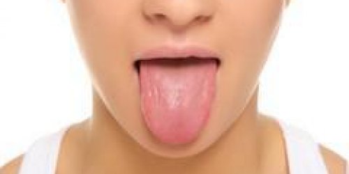 Perdre 10 kilos en 1 mois grace a un patch cousu sur la langue