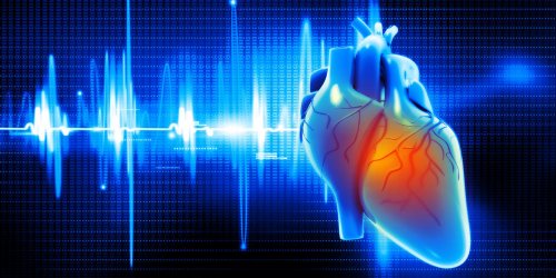 Arret cardiaque ou crise cardiaque : la difference