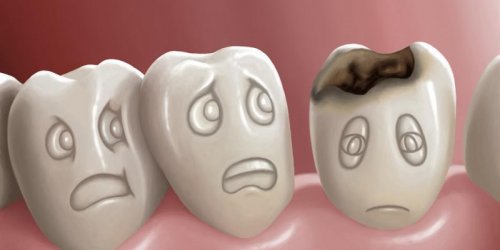 Rage de dents : que faire pour calmer cette douleur dentaire ?