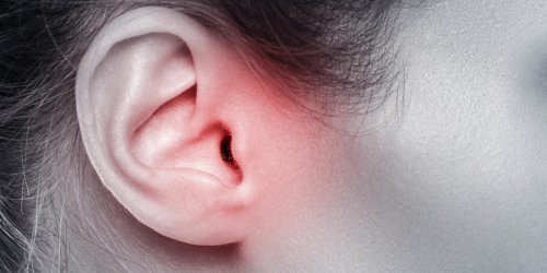 Tumeur de l-oreille interne : le neurinome