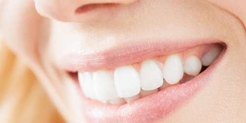 Prothese dentaire amovible : comment la nettoyer ?