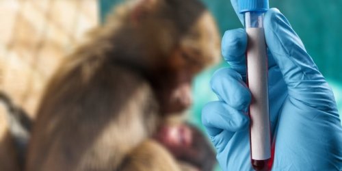 Zoonose : un virus similaire au VIH bientot responsable d’une nouvelle pandemie ?