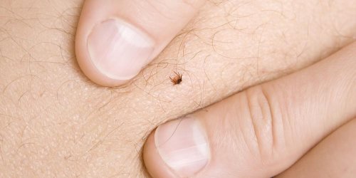 Maladie de Lyme : reconnaitre la lesion typique de l’infection 