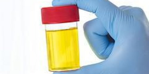Savez-vous ce qu-il y a dans votre urine ?