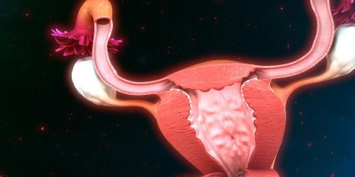 Cancer des ovaires : comment se passe le depistage