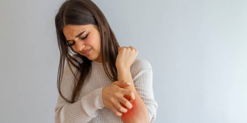 Eczema, une maladie de peau qui impacte aussi la vie de couple