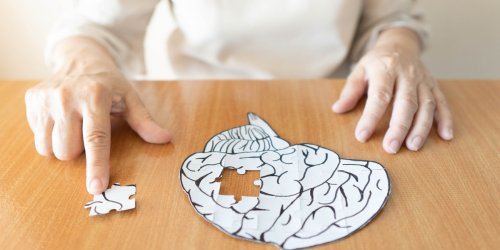 Alzheimer : ces 3 facteurs de risque surprenants peuvent provoquer la maladie