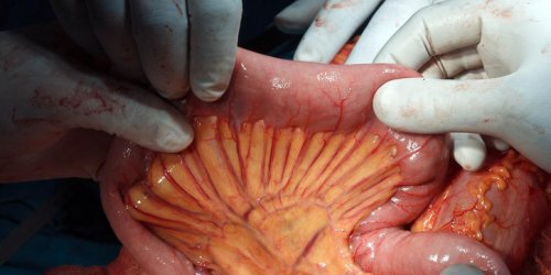 Un nouvel organe decouvert dans le corps humain : le mesentere