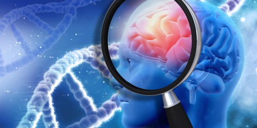 Maladie d’Alzheimer : deux nouveaux genes responsables identifies 