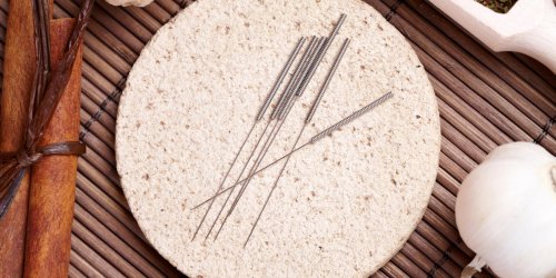 Les points d-acupuncture pour traiter les acouphenes