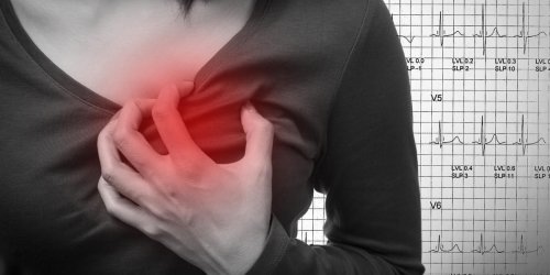 Crise cardiaque : les femmes appellent plus souvent les secours pour les hommes que pour elles