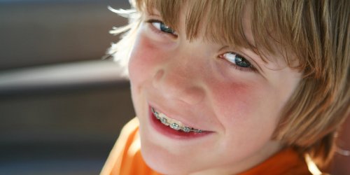 Orthodontie chez l-enfant : est-elle remboursee ?