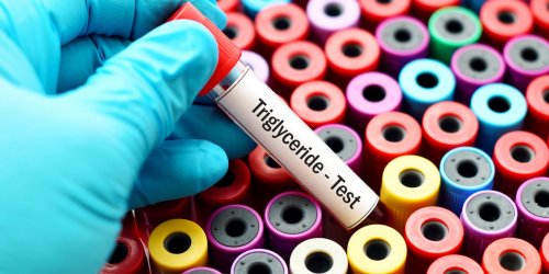 Exces de triglycerides : quel traitement ?