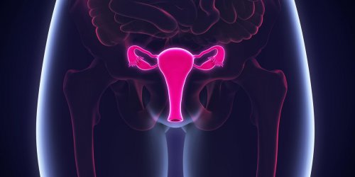 Cancer de l-ovaire : une evolution possible vers le peritoine